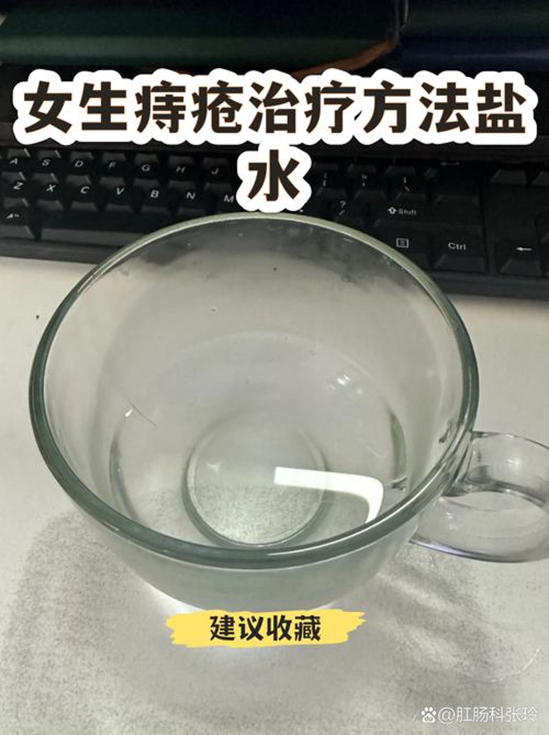警惕痔疮治疗的三大误区