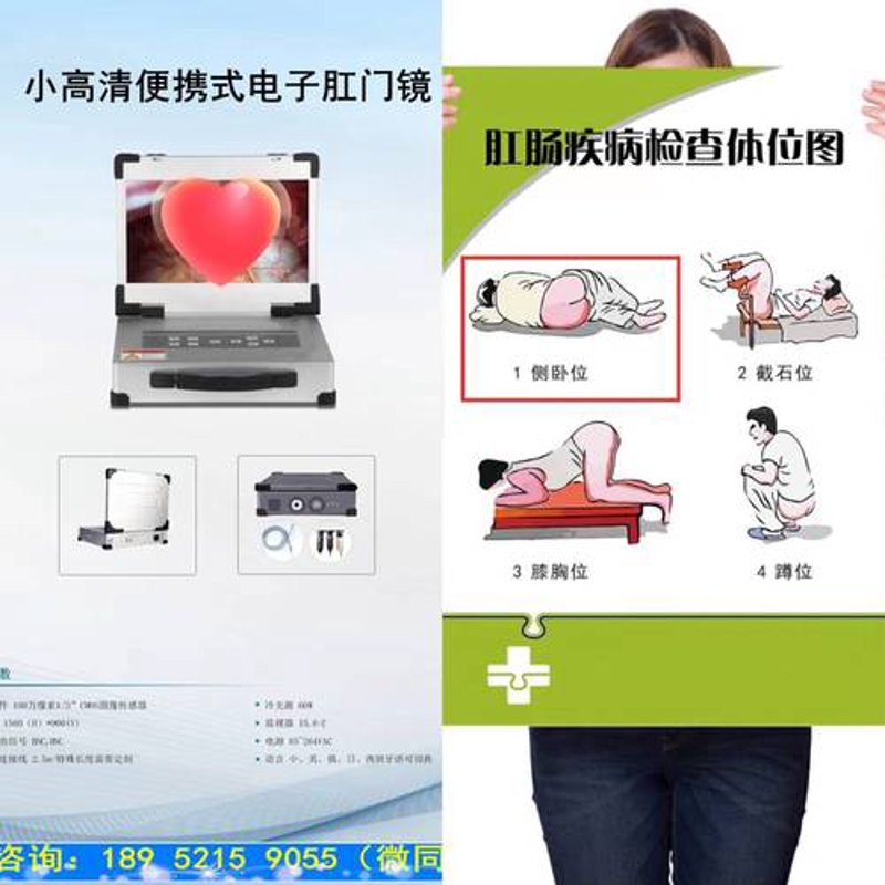 肛门镜检查